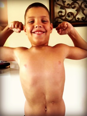 Joshua showing off his scars.